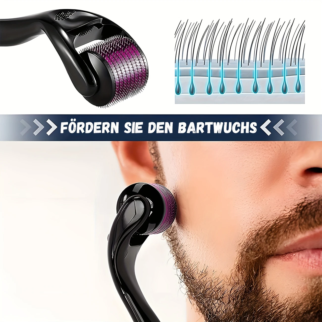 Derma Roller, 540 Needle Cross-Line Derma Roller - Image 6