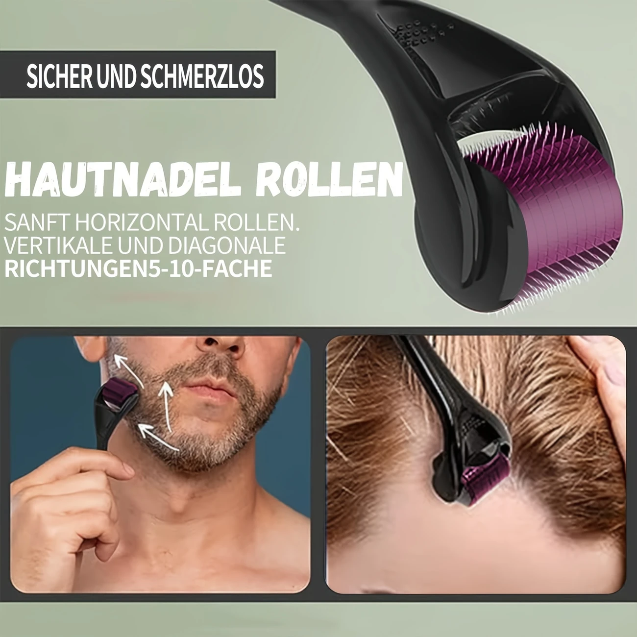 Derma Roller, 540 Needle Cross-Line Derma Roller - Image 5